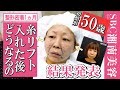 【アラフィフ糸リフト整形密着】ダウンタイム完全公開!若返り度・痛み・肌質の変化を正直レポートしました【タルミ・ほうれい線・フェイスラインを引き上げて小顔】@湘南美容クリニック
