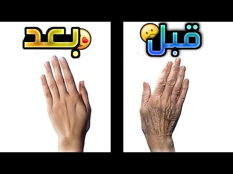 أفضل طريقة لإزالة البقع البنية على اليدين طريقة مضمونة  أفضل طريقة لإزالة البقع البنية على اليدين طريقة مضمونة