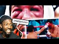 Opponents BEFORE and AFTER Fighting Manny Pacquiao | Reaction