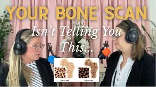 Bone Density vs. Bone Quality — Why Your T-Score Isn’t the Whole Story