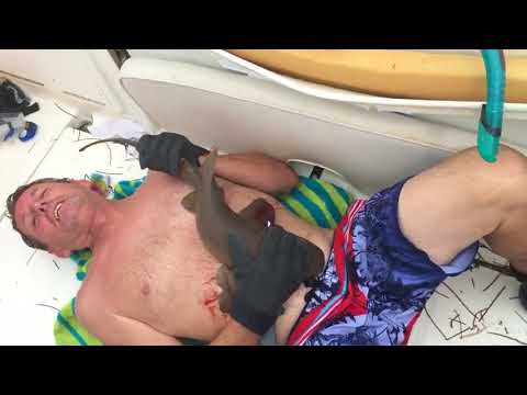 IMPACTANTE: Pequeño tiburón muerde a un hombre en el vientre y no lo suelta