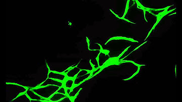 Tubule Formation - GFP transfected HUVEC cells (cellworks.co.uk)