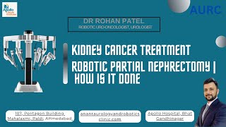 Robotic Partial Nephrectomy | What it is, Benefits & What patients should Expect | Dr Rohan Patel