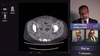 Abdominal Emergency Radiology Course - Trailer screenshot 5