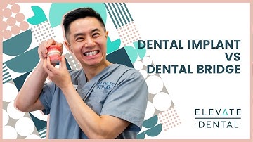 Dental Implant Vs Dental Bridge
