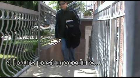 6 Months CCSVI before after compilation