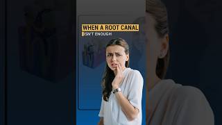 When a Root Canal Isn’t Enough | Apicoectomy Explained