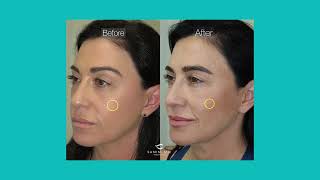 Dr. David Samimi's Philosophy on the Aging Face | Eyesthetica | Los Angeles, CA