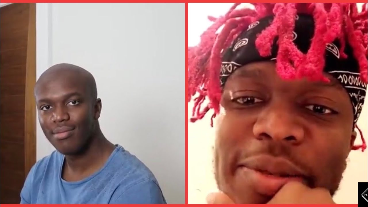 ksi, baldski, ksi baldski, ksi is afraid of going bald, ksi going bald, ksi s...