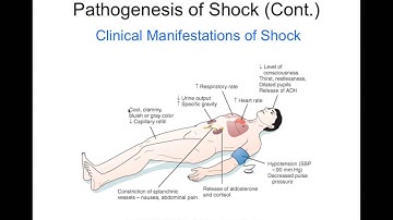 Chapter 20 Shock BIOL300