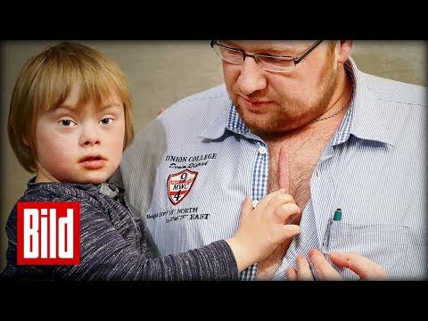 Vater Lasst Sich Die Op Narbe Seines Sohnes Brennen Youtube