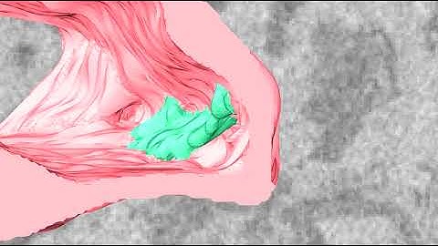 Serial block-face scanning electron microscopy of equine exuberant granulation tissue