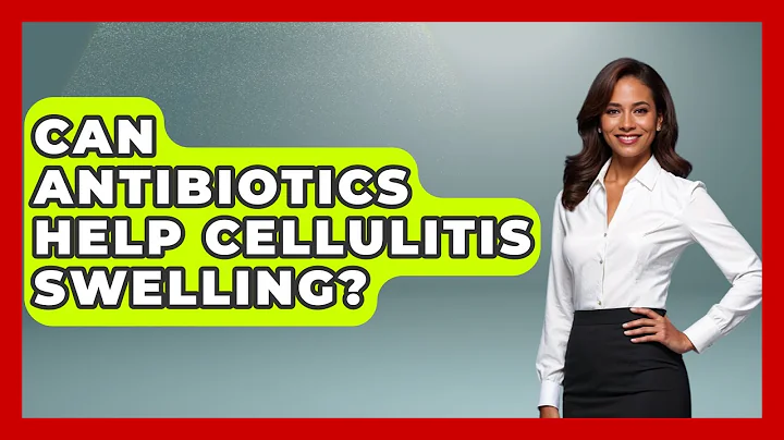 Can Antibiotics Help Cellulitis Swelling? - The Disease Encyclopedia