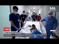 Новини світу: турецькі медики успішно прооперували сіамських близнючок