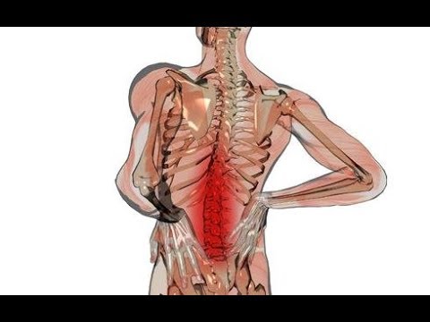 Vídeo: Coneix Quasimodo, Un Gos Amb Rara Síndrome De La Columna Vertebral Curta Que Prospera