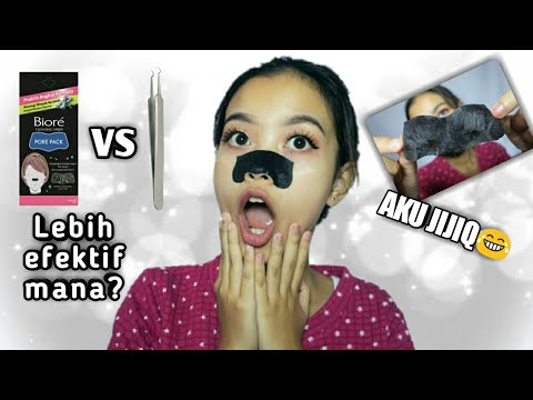 Cara Bersihin Komedo Pake Pore Pack Secara Maksimal | Pore Strip vs Pinset Komedo | Primadita R