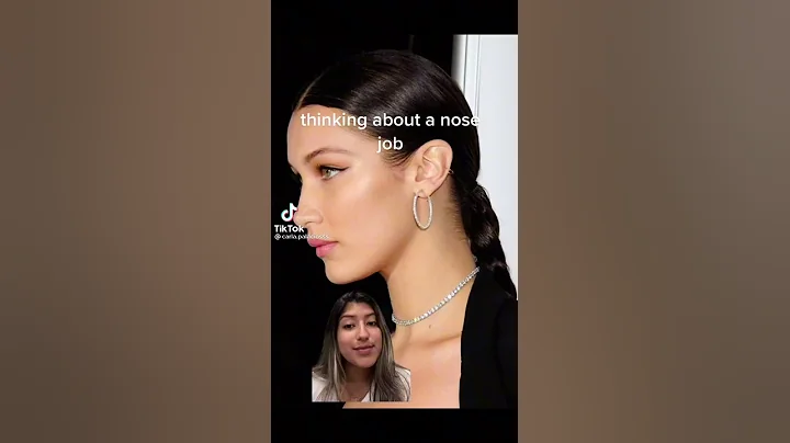 Rhinoplasty Journey TikTok - Dr. Anthony Bared, MD, FACS | Miami FL - DayDayNews