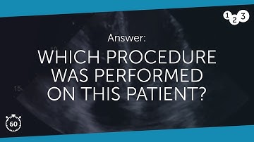 60 Seconds of Echo Teaching Question: Which procedure was performed on this patient?