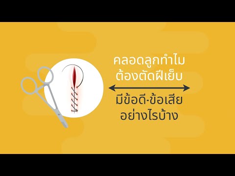 วีดีโอ: ฝีเย็บคืออะไร?