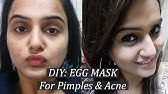 Download Benefits Of Egg White Face Mask For Acne Egg White Face Mask Tips Youtube Yellowimages Mockups