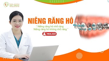 Niềng răng hô ở người trưởng thành - Case lâm sàng thực tế