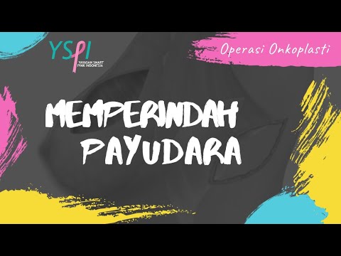 CARA MEMBENTUK PAYUDARA MENJADI LEBIH INDAH !!! Pasca Operasi Mastektomi pada Kanker Payudara