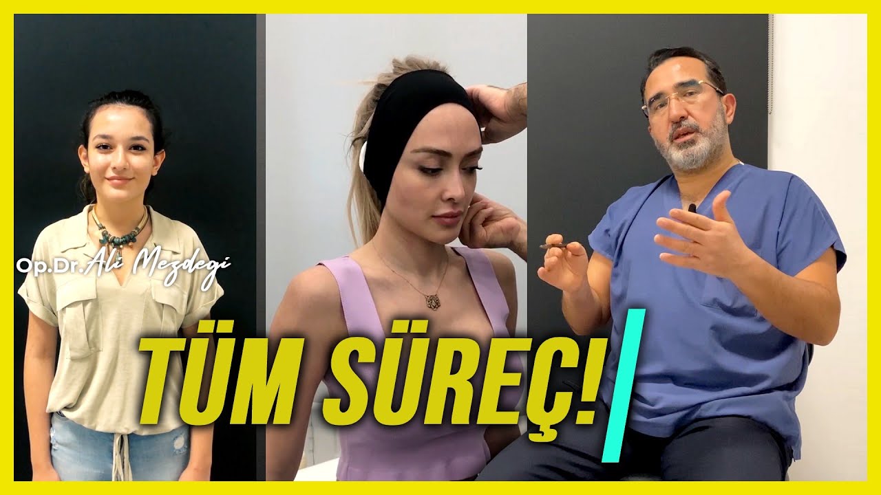 Kepçe Kulak Estetiği Tüm Süreç (Mutlaka İzleyin)