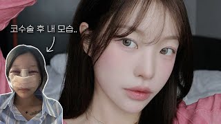 코수술 전 마지막 GRWM .. 요즘 매일 하는 뽀용핑크 메이크업️ | 소윤Soyoon