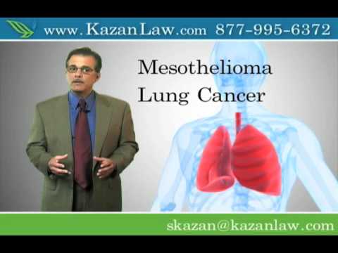 asbestos-exposure-causes-lung-cancer-and-mesothelioma--video