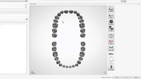 Create a New Order in the Dental System™