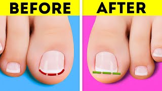Feet care and pedicure hacks you can easily repeat at home