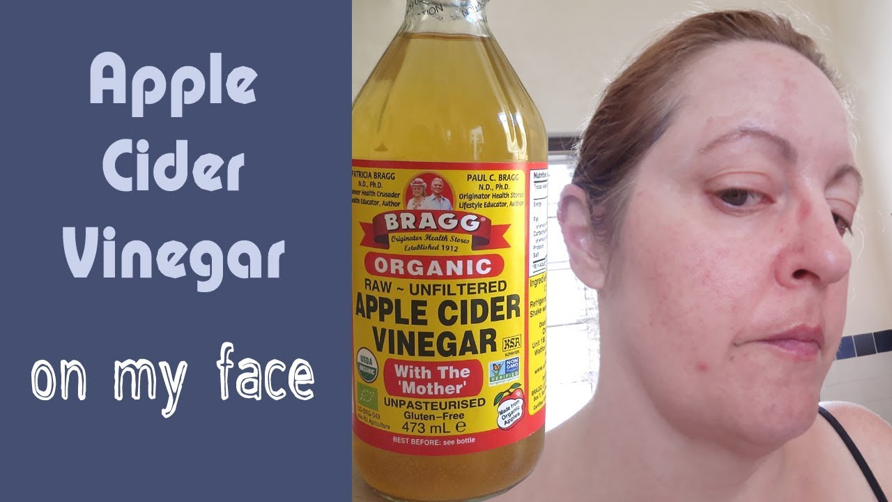 Apple Cider Vinegar On My Face Before And After Youtube