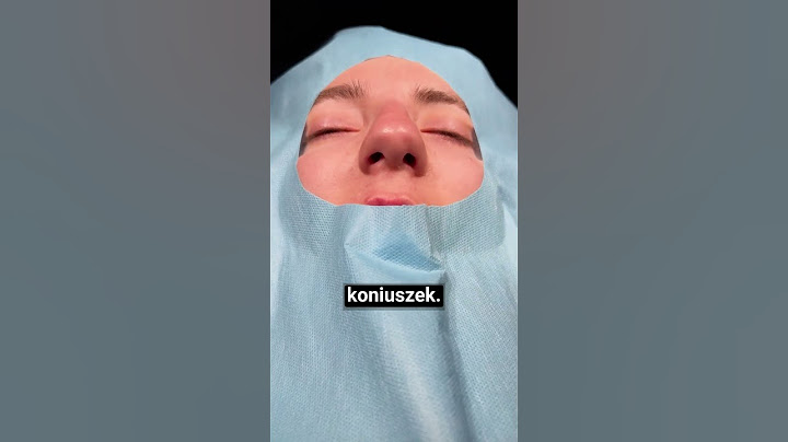 Złamany nos