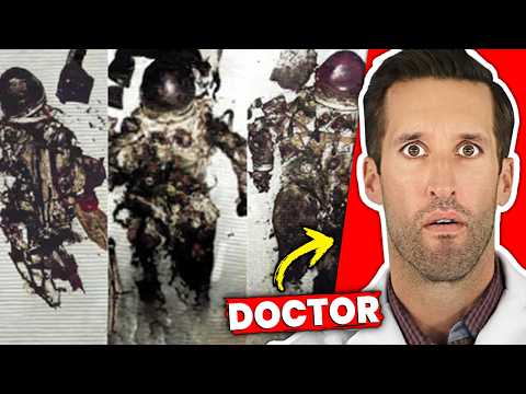 ER Doctor REACTS to WORST Space Deaths Ever