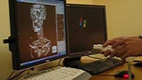 Wii remote to control TeraRecon 3D rendering systems at WFU