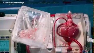 Doctors Revive and Transplant Hearts That Have Already Stopped Beating