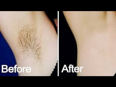 بمسحة واحدة تخلصي من شعر العانة بدون ألم نهائيا - إزالة شعر الجسم