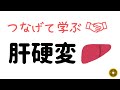 【つなげて学ぶ】肝硬変