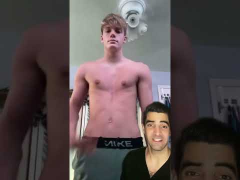 Vídeo: Com arreglar el pit caigut sense cirurgia?