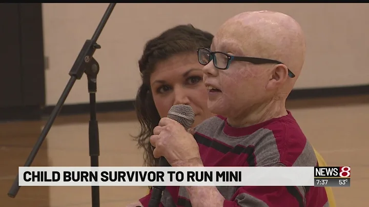 Boy survives boiling water burns, set to race in Indy 500 Mini