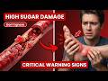 What If Your Blood Sugar Stayed High for Years?
