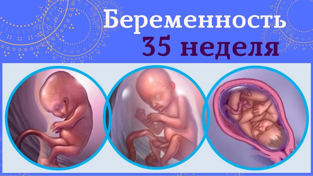 35 неделя беременности Все для беременных Мария Супрунюк - YouTube
