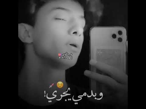 حبك مرض بروح ودمي يجري غيرك فلا حبيت بس الله يدري احبك اشترك في القناة وحط لايك