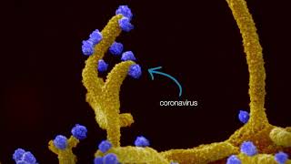 Coronavirus forces cells to produce tentacle-like structures that infect neighboring cells