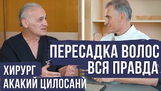 ПЕРЕСАДКА ВОЛОС ‼️ВСЯ ПРАВДА ОТ ХИРУРГА АКАКИЯ ЦИЛОСАНИ