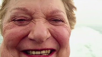 Wrinkle recognition software 2.OMG