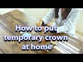 How to Reattach a Temporary Crown at Home 🦷