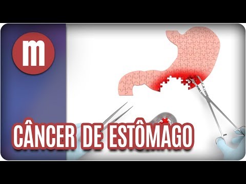 verruga no estomago é cancer