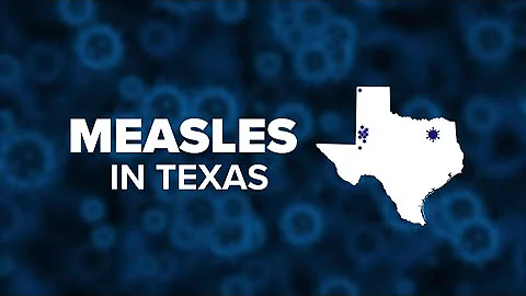 More measles cases reported in Texas: Latest data and everything we know