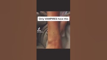 Thumbnail of Seeing if I have the Vampire Mark #shorts